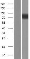 SRRM3 Human Over-expression Lysate