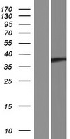 C6orf136 Human Over-expression Lysate