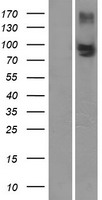 MRP4 (ABCC4) Human Over-expression Lysate