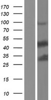 MST4 (STK26) Human Over-expression Lysate