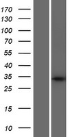 C6orf140 (GLYATL3) Human Over-expression Lysate