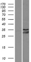 IP6K1 Human Over-expression Lysate