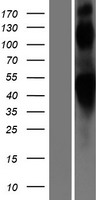 beta 2 Adrenergic Receptor (ADRB2) Human Over-expression Lysate