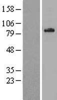 ABCD1 Human Over-expression Lysate
