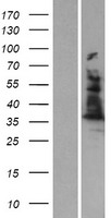 ALAD Human Over-expression Lysate