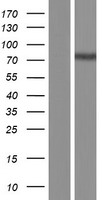 CPT2 Human Over-expression Lysate