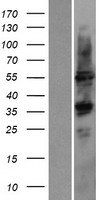 Cytochrome P450 2D6 (CYP2D6) Human Over-expression Lysate
