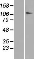 DPYD Human Over-expression Lysate