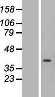 ETFA Human Over-expression Lysate