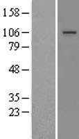 MTTP Human Over-expression Lysate
