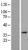 PEX2 Human Over-expression Lysate