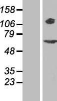 RPGR Human Over-expression Lysate