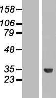 ROM1 Human Over-expression Lysate