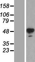 Tyrosine Hydroxylase (TH) Human Over-expression Lysate