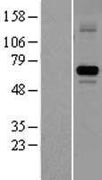 Steroid sulfatase (STS) Human Over-expression Lysate