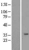 SLC25A20 Human Over-expression Lysate
