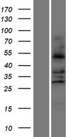 Aldehyde dehydrogenase 10 (ALDH3A2) Human Over-expression Lysate