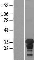 XPA Human Over-expression Lysate