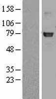 GLB1 Human Over-expression Lysate