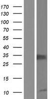 IL2 Receptor alpha (IL2RA) Human Over-expression Lysate