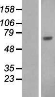 Albumin (ALB) Human Over-expression Lysate