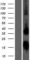 TSH beta (TSHB) Human Over-expression Lysate