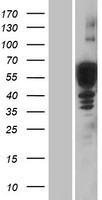 Doublecortin (DCX) Human Over-expression Lysate