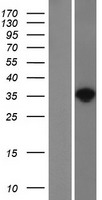 NAT1 Human Over-expression Lysate