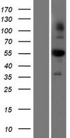 ALDH1B1 Human Over-expression Lysate