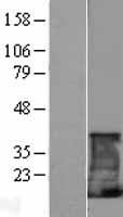 CD247 Human Over-expression Lysate