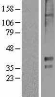 5HT1E Receptor (HTR1E) Human Over-expression Lysate