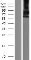 PDE9A Human Over-expression Lysate
