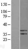 PTER Human Over-expression Lysate