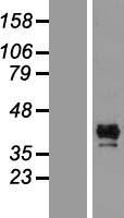 CALHM1 Human Over-expression Lysate