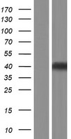LHX8 Human Over-expression Lysate