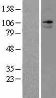 Anoctamin 7 (ANO7) Human Over-expression Lysate
