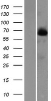 FAM116B (DENND6B) Human Over-expression Lysate