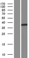 IL17REL Human Over-expression Lysate