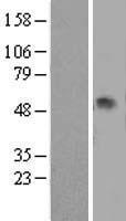 alpha 1 Antitrypsin (SERPINA1) Human Over-expression Lysate