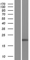 STAG3L1 Human Over-expression Lysate