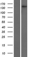 SMC4 Human Over-expression Lysate