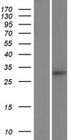 C18orf1 (LDLRAD4) Human Over-expression Lysate