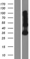 LY6G6F Human Over-expression Lysate