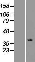 OR2L2 Human Over-expression Lysate
