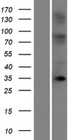OR10T2 Human Over-expression Lysate
