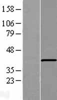 TMEM195 (AGMO) Human Over-expression Lysate