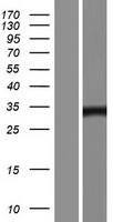 PP14397 (JMJD8) Human Over-expression Lysate