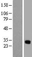 GJB3 Human Over-expression Lysate