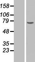 Chk2 (CHEK2) Human Over-expression Lysate