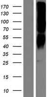 OR2T8 Human Over-expression Lysate
